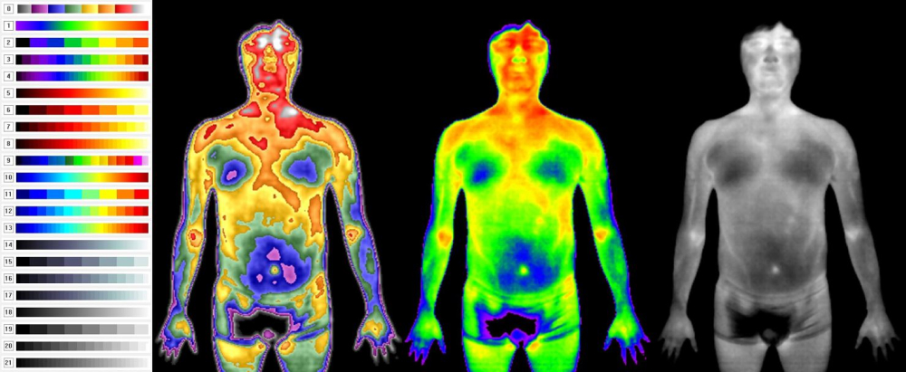 human body osteoporosis diagnosis