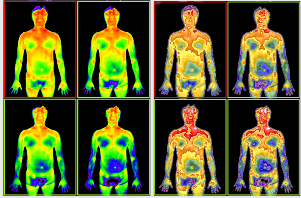human body osteoporosis diagnosis