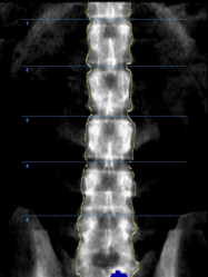 small animal X-ray