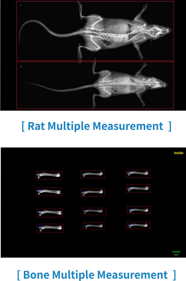 X-ray osteoporosis diagnosis